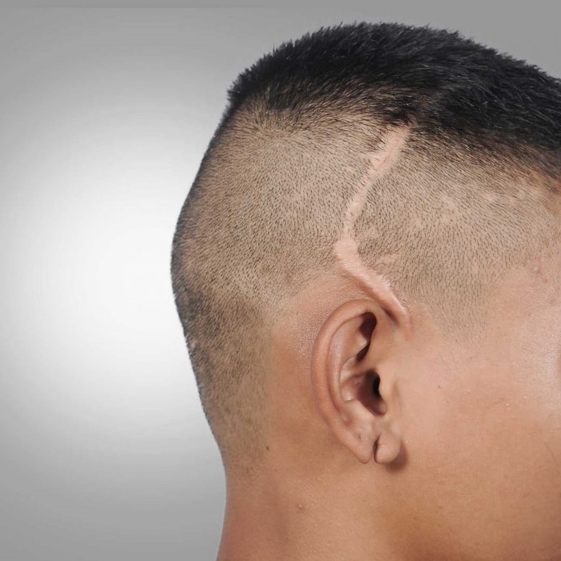 scar-camoflague-tattoo-auckland